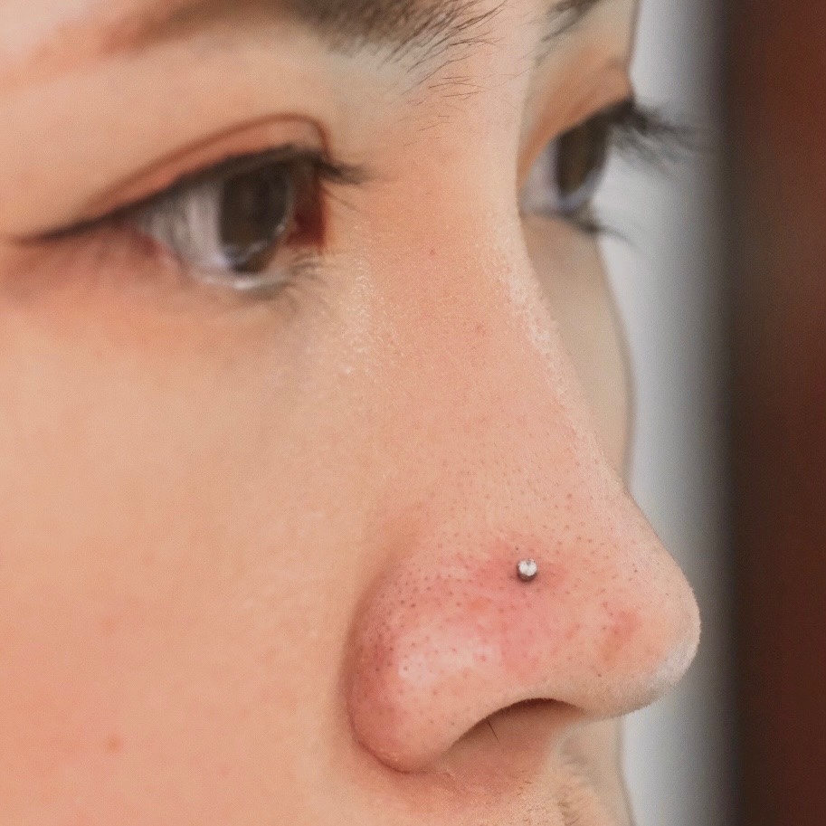 From Irritation to Recovery: A Nose Piercing Healing Story