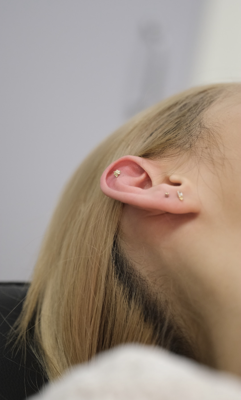 Understanding Hypertrophic Scars and Keloids After Piercing