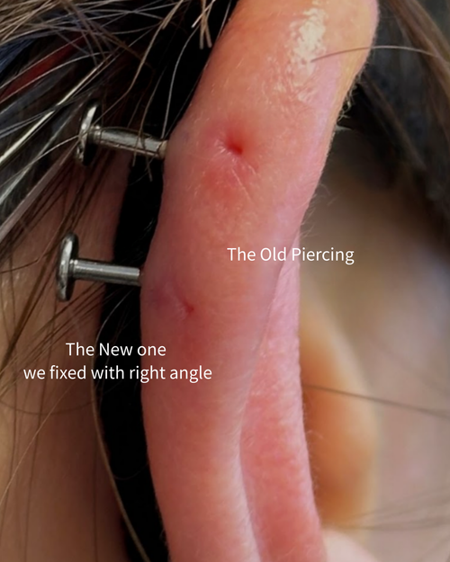 Wound Care